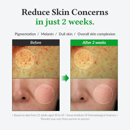 Dr.Althea Post Acne Care Set (Gentle) | 345 Relief Cream & Gentle Vitamin C Serum